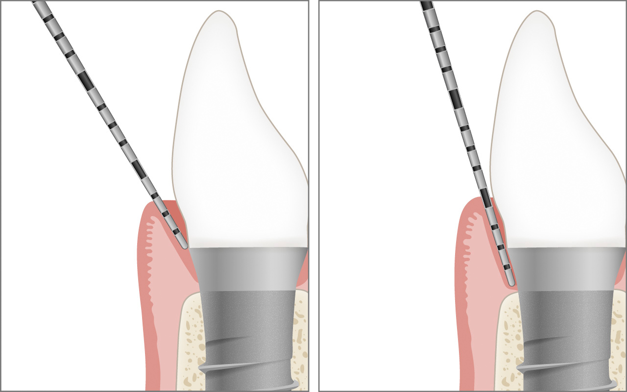 Sondaggio impianto profondo